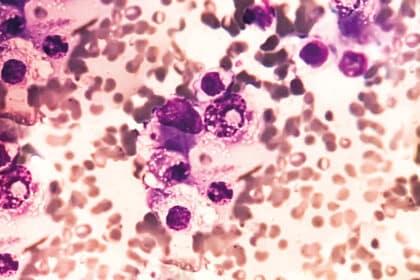 Mikroskopische Aufnahme von Blutzellen mit violett gefärbten Zellstrukturen.