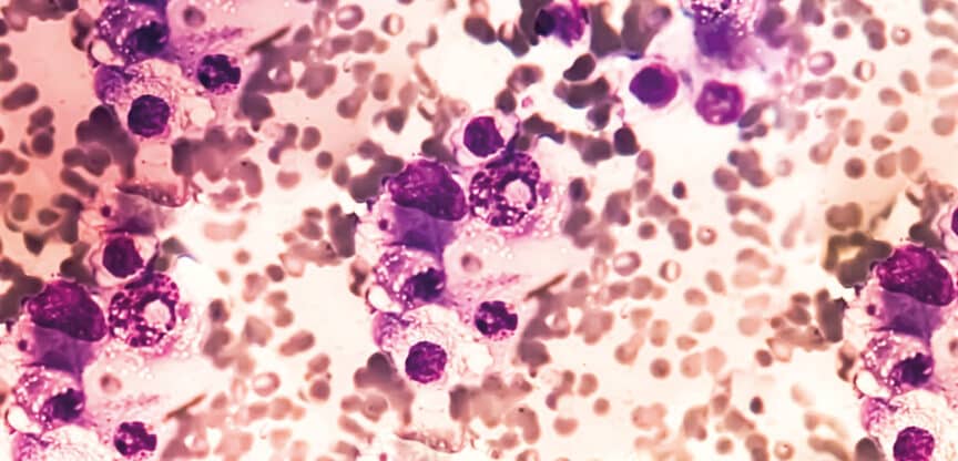 Mikroskopische Aufnahme von Blutzellen mit violett gefärbten Zellstrukturen.