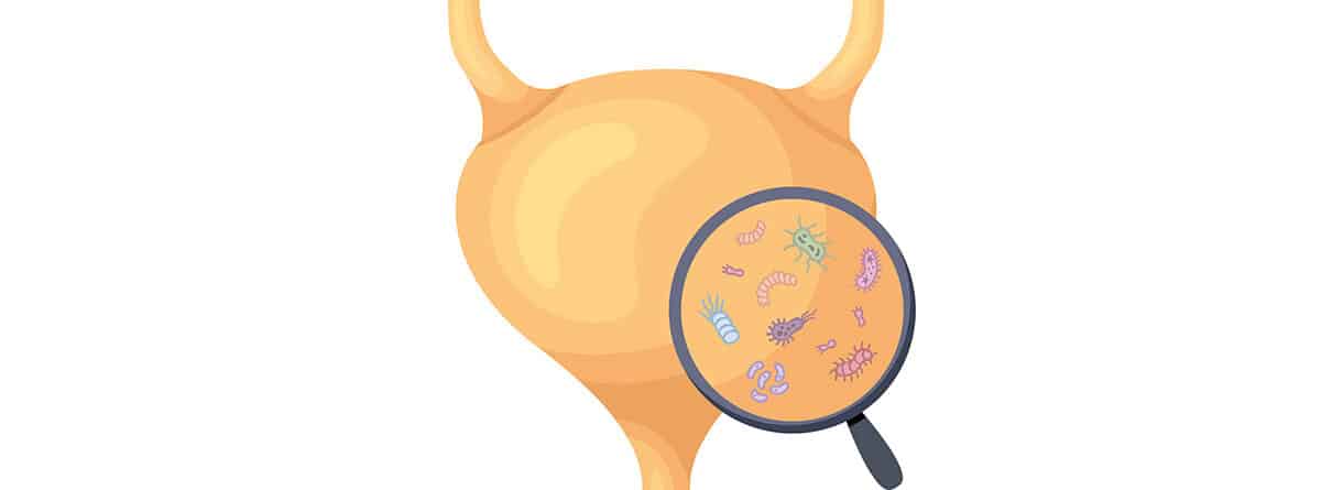 Illustration einer Blasenentzündung auf weißem Hintergrund