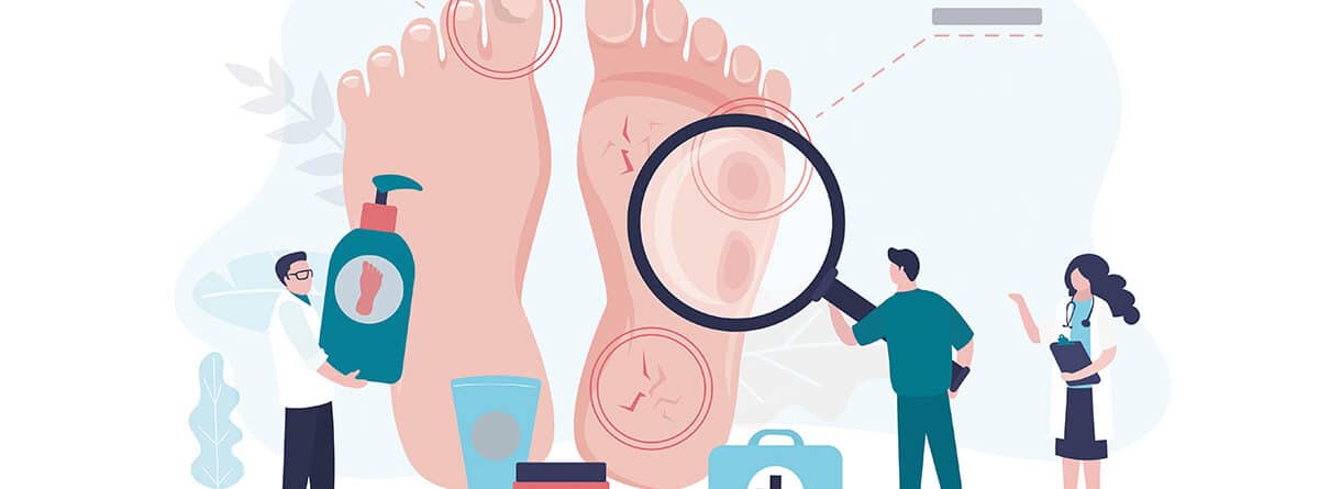 Illustration von Füßen mit Druckstellen, Hühneraugen und Hautrissen sowie medizinischer Untersuchung und Pflegeprodukten zur Fußgesundheit.