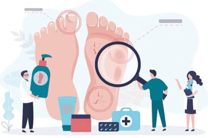 Illustration von Füßen mit Druckstellen, Hühneraugen und Hautrissen sowie medizinischer Untersuchung und Pflegeprodukten zur Fußgesundheit.
