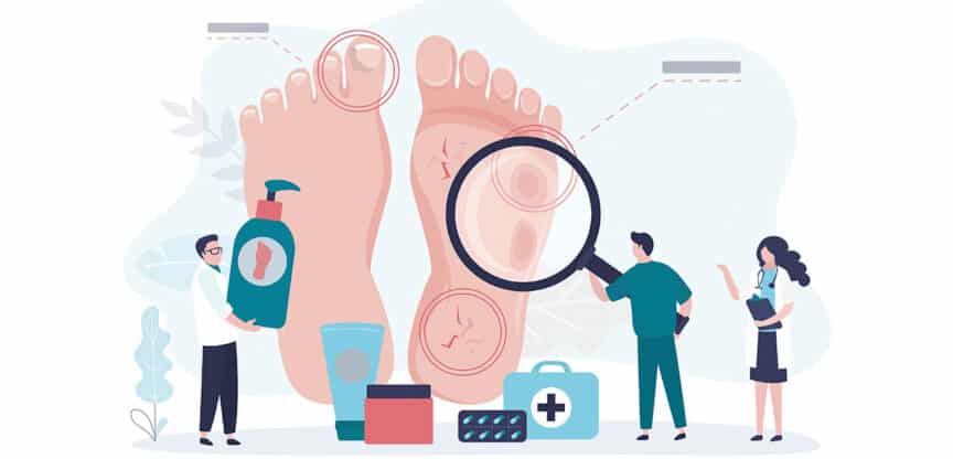 Illustration von Füßen mit Druckstellen, Hühneraugen und Hautrissen sowie medizinischer Untersuchung und Pflegeprodukten zur Fußgesundheit.