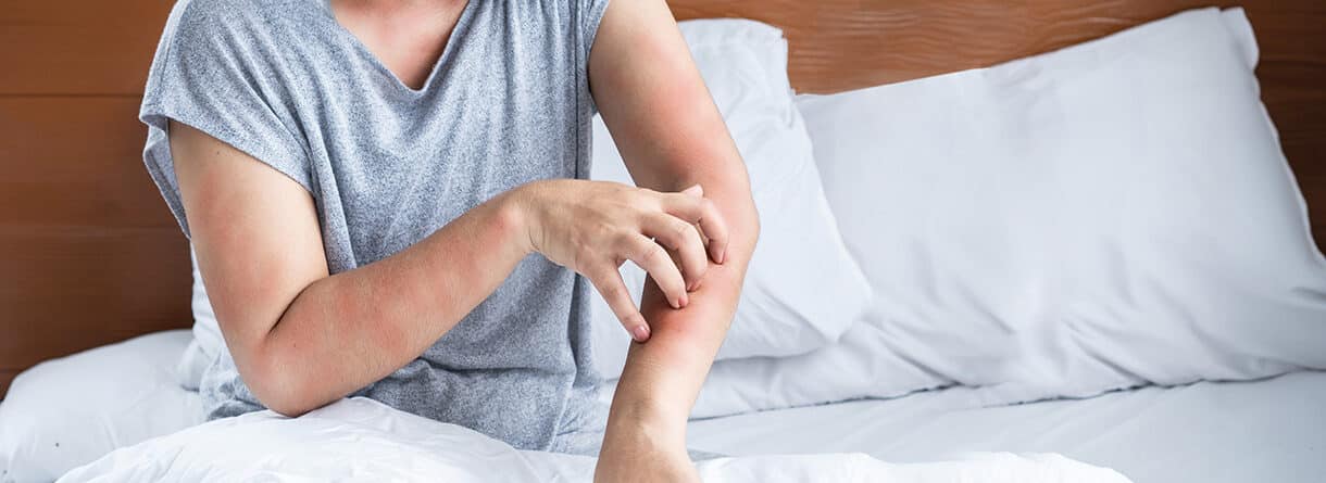 Person kratzt sich wegen geröteter, juckender Hautstellen am Arm und Ellenbogen – Symbolbild für Hautreizungen, Ekzeme oder Allergien.