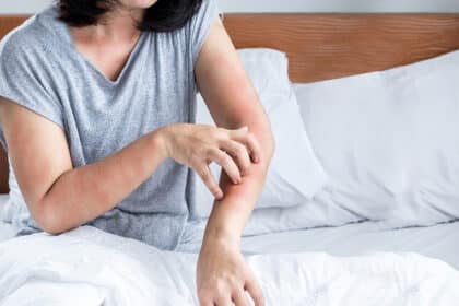 Person kratzt sich wegen geröteter, juckender Hautstellen am Arm und Ellenbogen – Symbolbild für Hautreizungen, Ekzeme oder Allergien.