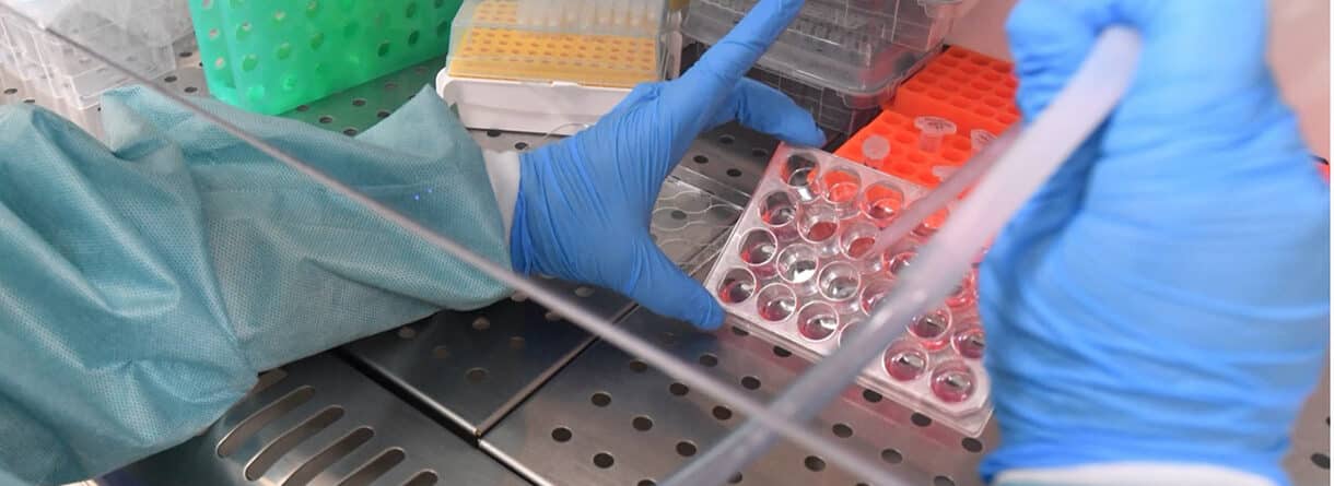 Laborarbeit mit Pipette und Zellkulturplatte zur wissenschaftlichen Untersuchung von Covid-19.