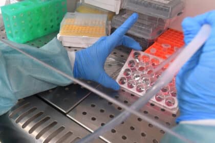 Laborarbeit mit Pipette und Zellkulturplatte zur wissenschaftlichen Untersuchung von Covid-19.