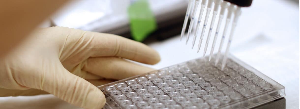 Laborarbeit mit Mehrkanalpipette und Mikrotiterplatte zur Erforschung und Entwicklung neuer Impfstoffe.