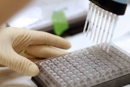 Laborarbeit mit Mehrkanalpipette und Mikrotiterplatte zur Erforschung und Entwicklung neuer Impfstoffe.
