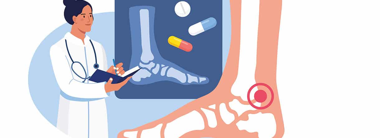 Illustration einer ärztlichen Untersuchung bei Schmerzen im Sprunggelenk mit Röntgenbild des Fußes.