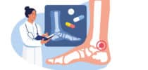 Illustration einer ärztlichen Untersuchung bei Schmerzen im Sprunggelenk mit Röntgenbild des Fußes.