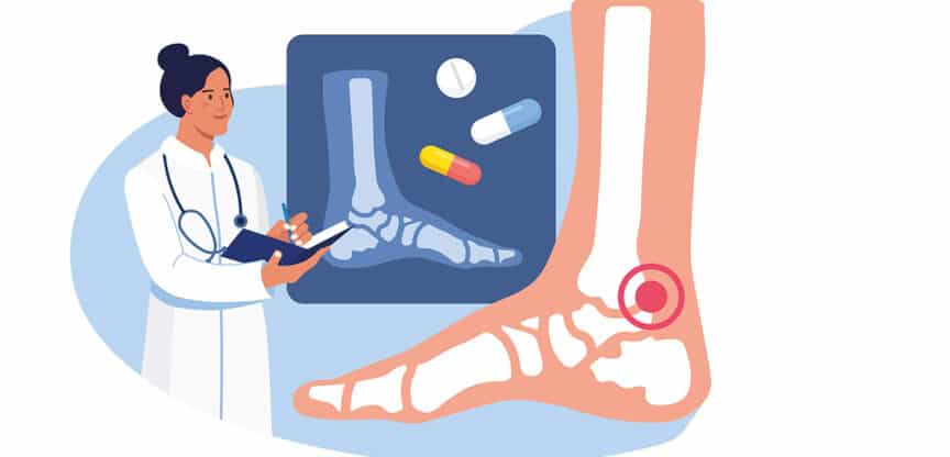 Illustration einer ärztlichen Untersuchung bei Schmerzen im Sprunggelenk mit Röntgenbild des Fußes.