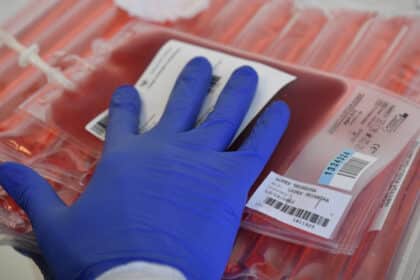 Nahaufnahme einer behandschuhten Hand, die einen beschrifteten Blutbeutel auf mehreren medizinischen Blutkonserven hält.