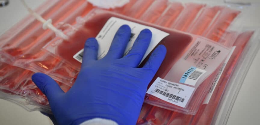 Nahaufnahme einer behandschuhten Hand, die einen beschrifteten Blutbeutel auf mehreren medizinischen Blutkonserven hält.