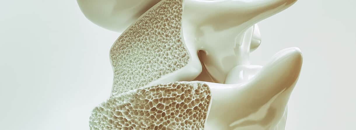 3D-Darstellung eines Wirbelknochens im Querschnitt mit sichtbarer poröser Knochenstruktur.