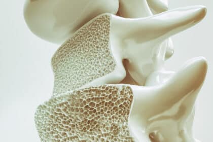 3D-Darstellung eines Wirbelknochens im Querschnitt mit sichtbarer poröser Knochenstruktur.