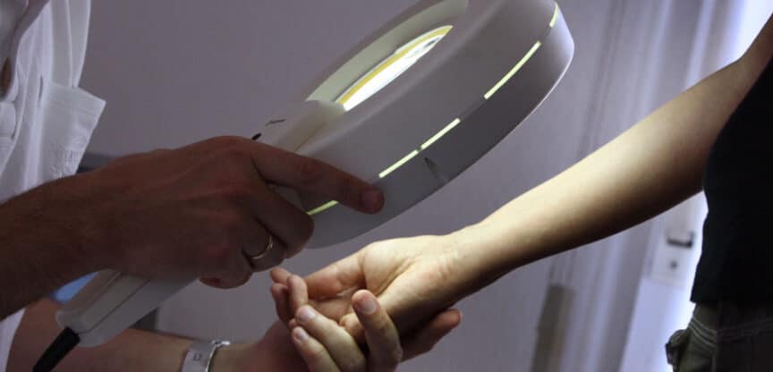 Dermatologische Untersuchung der Haut am Unterarm mit einer beleuchteten Lupe zur Hautkrebsvorsorge.